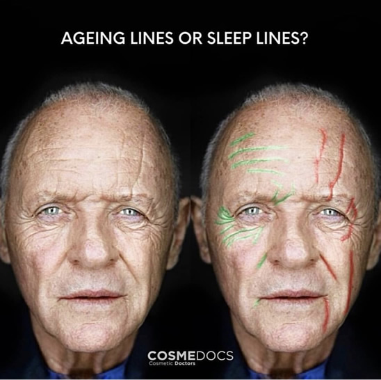 Sleeping Lines Vs. Aging Lines