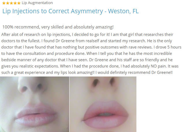 Weston Florida Lip Augmentation Testimonial