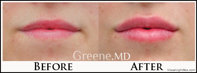 before_after_image_combined