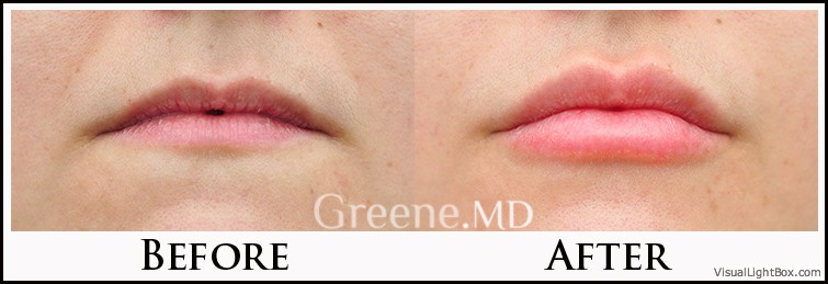 before_after_image_combined