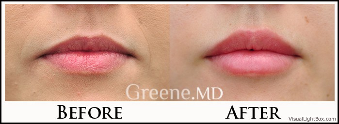 before_after_image_combined