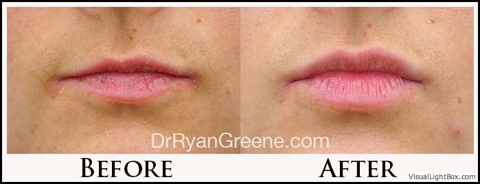 before_after_image_combined