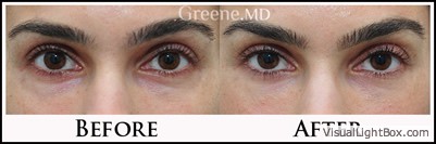 before_after_image_combined