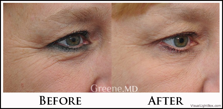 before_after_image_combined