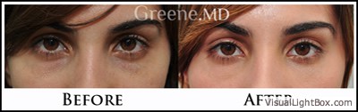 before_after_image_combined