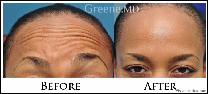 before_after_image_combined