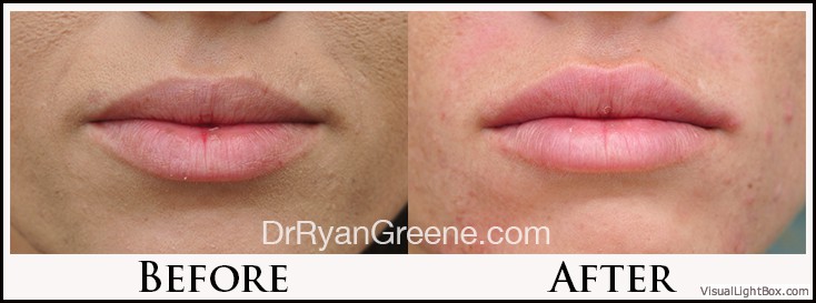 before_after_image_combined