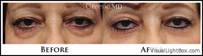 before_after_image_combined