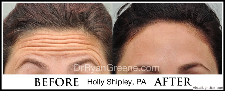 before_after_image_combined