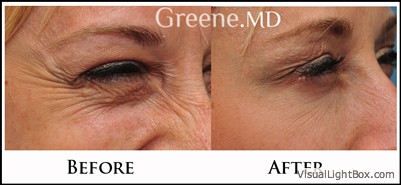 before_after_image_combined