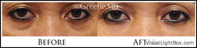 before_after_image_combined