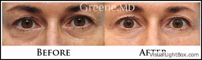 before_after_image_combined