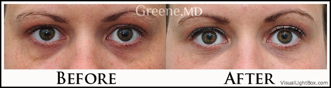 before_after_image_combined