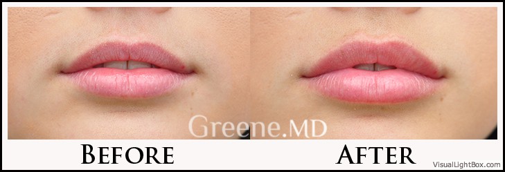 before_after_image_combined
