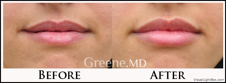 before_after_image_combined