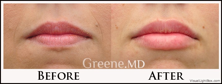 before_after_image_combined