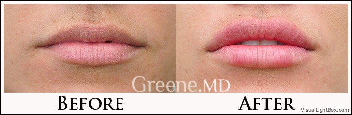 before_after_image_combined