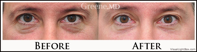 before_after_image_combined