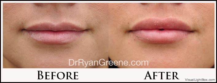 before_after_image_combined