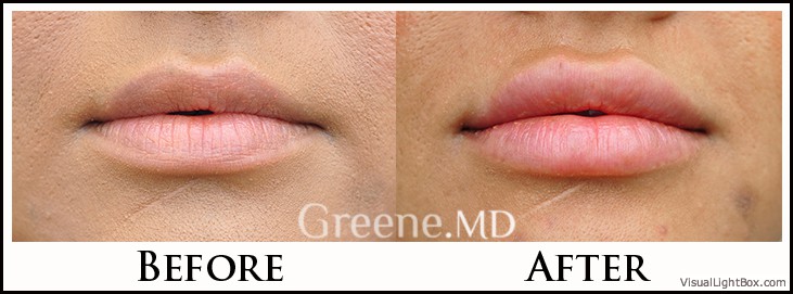 before_after_image_combined