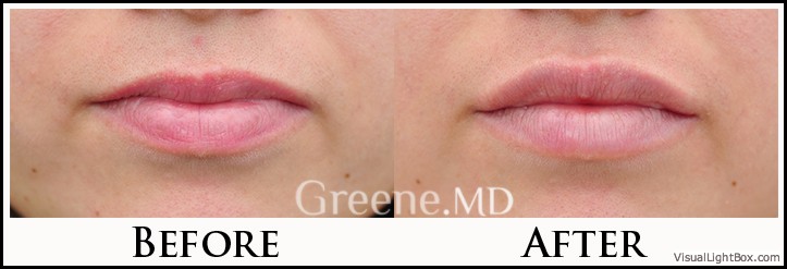 before_after_image_combined