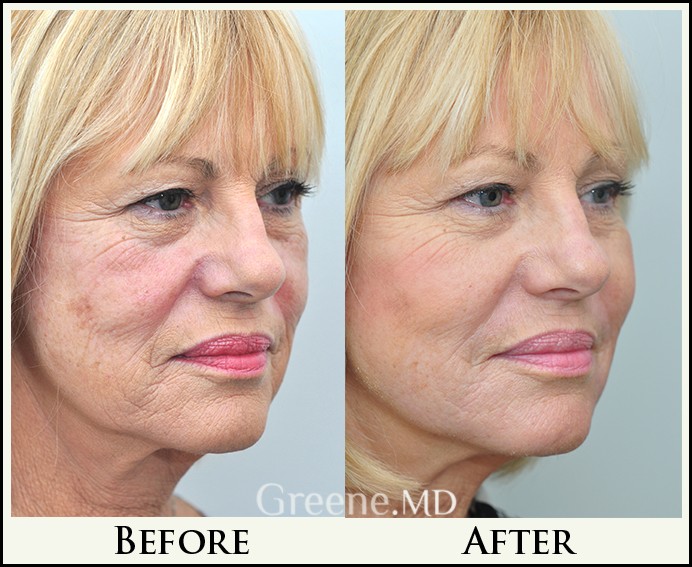 before_after_image_combined