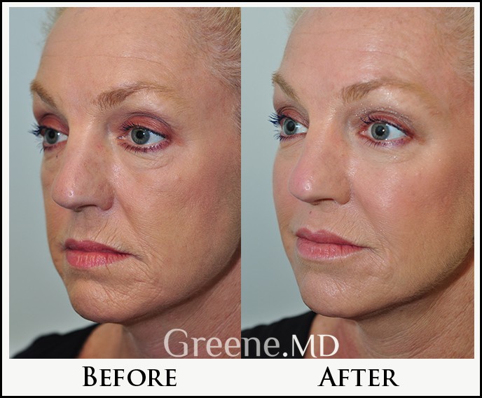 before_after_image_combined