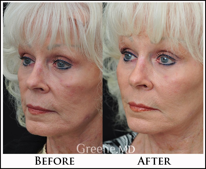 before_after_image_combined