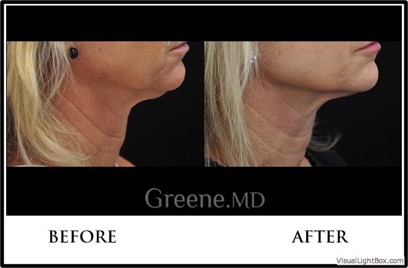 before_after_image_combined