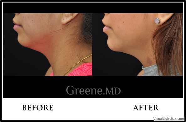 before_after_image_combined