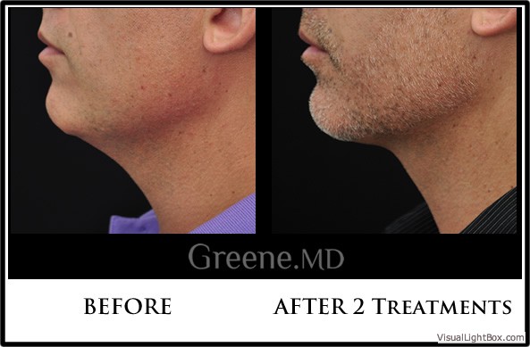 before_after_image_combined