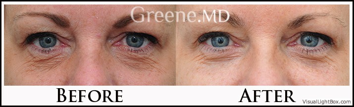 before_after_image_combined