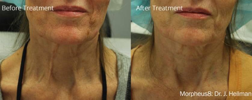 before_after_image_combined