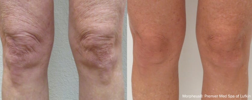 before_after_image_combined