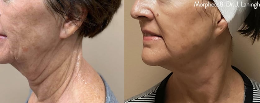 before_after_image_combined