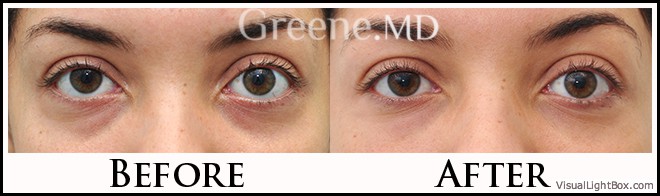 before_after_image_combined