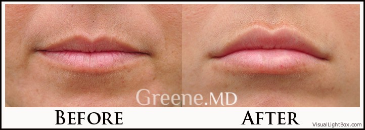 before_after_image_combined