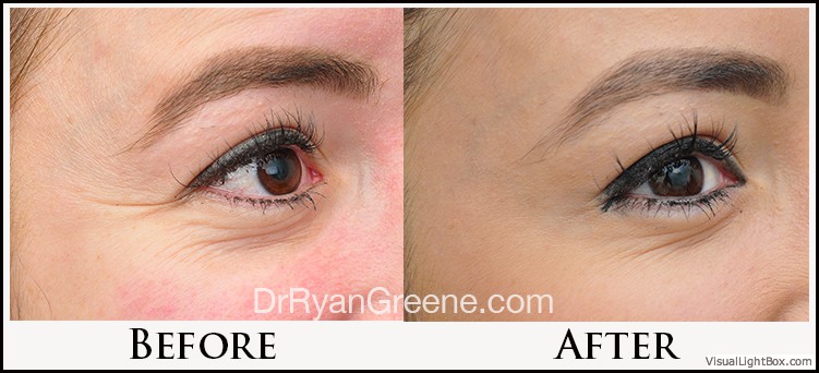 before_after_image_combined