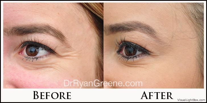 before_after_image_combined