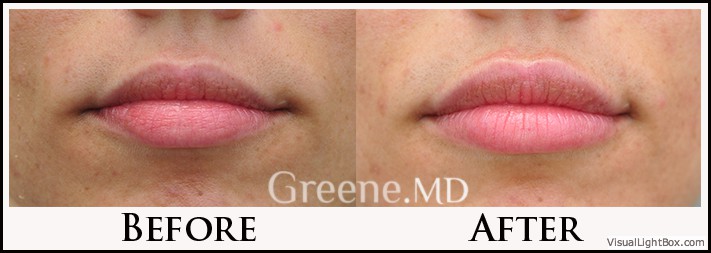before_after_image_combined