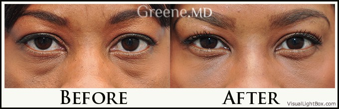 before_after_image_combined