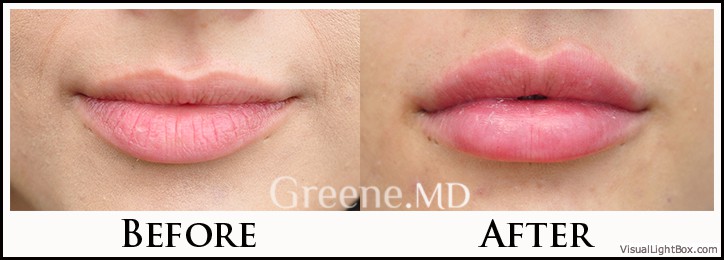 before_after_image_combined