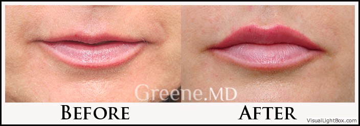 before_after_image_combined