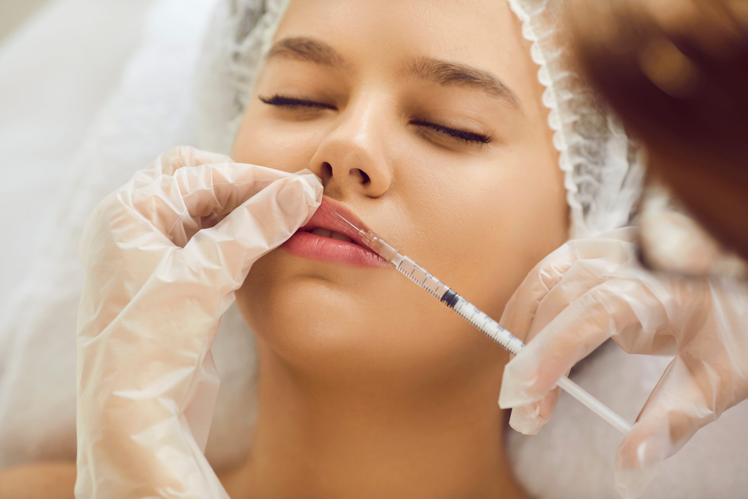 How much volume is in one syringe of filler? 