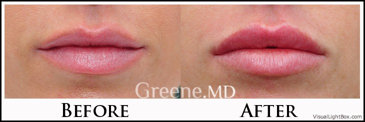 before_after_image_combined