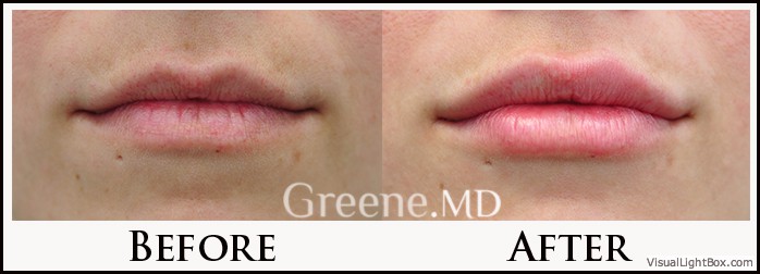 before_after_image_combined