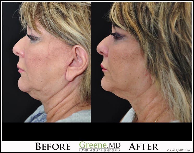 before_after_image_combined