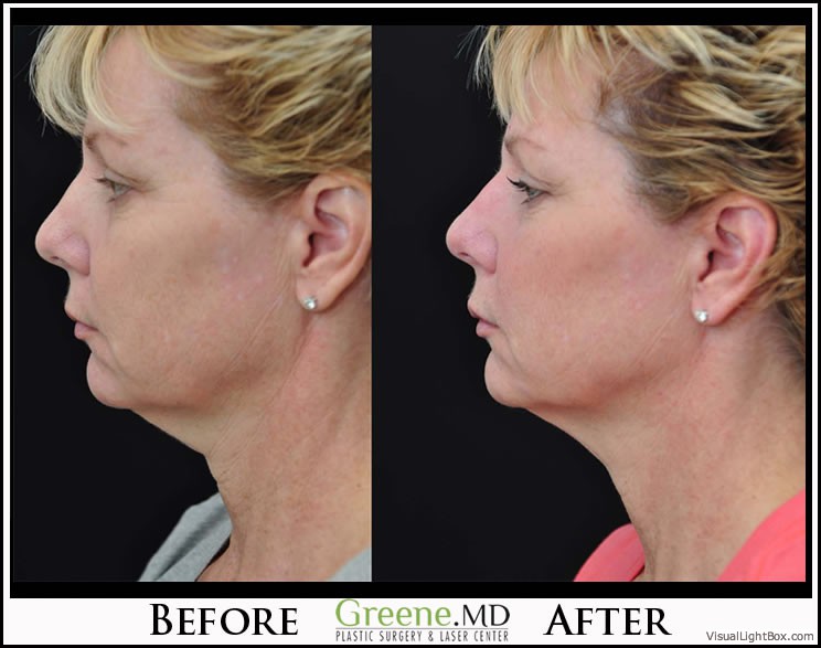 before_after_image_combined