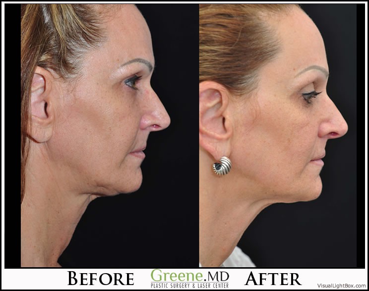 before_after_image_combined