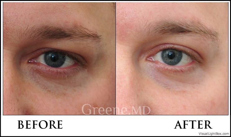 before_after_image_combined